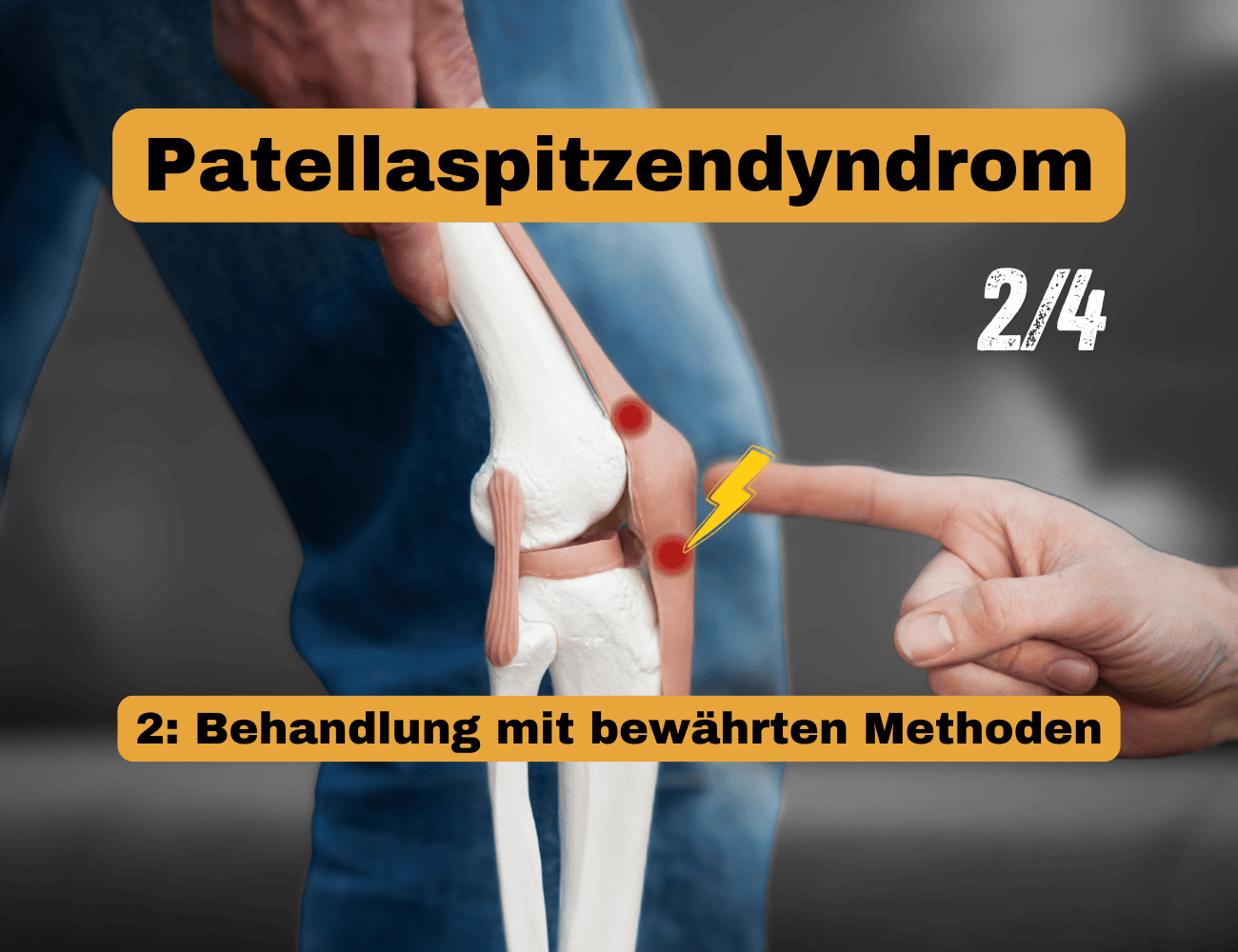 Patellaspitzensyndrom behandeln mit bewährten Therapieansätzen